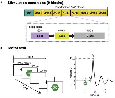 Frequency-Specific Effects of Galvanic Vestibular Stimulation on Response-Time Performance in Parkinson's Disease